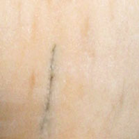 Marmor Rosa Portugal